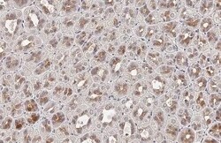 Invitrogen FN3K Recombinant Rabbit Monoclonal Antibody (HL2223) 100 &mu;L | Buy Online | Invitrogen&trade; | Fisher Scientific