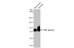 Invitrogen PKC gamma Recombinant Rabbit Monoclonal Antibody (HL2226) 100