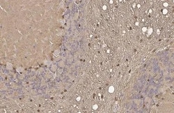 Invitrogen S100B Recombinant Rabbit Monoclonal Antibody (HL2228) 100 &mu;L;