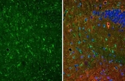 Invitrogen S100B Recombinant Rabbit Monoclonal Antibody (HL2228) 100 &mu;L;