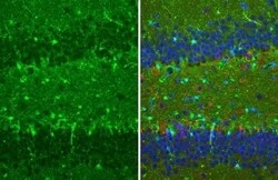Invitrogen S100B Recombinant Rabbit Monoclonal Antibody (HL2228) 100 &mu;L;