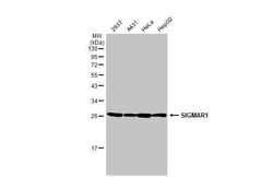 Invitrogen Sigma-1 Receptor Recombinant Rabbit Monoclonal Antibody (HL2230)