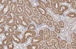 Invitrogen SLC27A2 Recombinant Rabbit Monoclonal Antibody (HL2232) 100 &mu;L | Buy Online | Invitrogen&trade; | Fisher Scientific