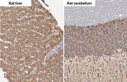 Invitrogen SLC27A2 Recombinant Rabbit Monoclonal Antibody (HL2232) 100 &mu;L | Buy Online | Invitrogen&trade; | Fisher Scientific