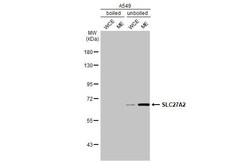Invitrogen SLC27A2 Recombinant Rabbit Monoclonal Antibody (HL2232) 100 &mu;L | Buy Online | Invitrogen&trade; | Fisher Scientific