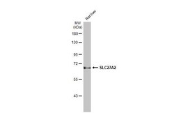 Invitrogen SLC27A2 Recombinant Rabbit Monoclonal Antibody (HL2232) 100 &mu;L | Buy Online | Invitrogen&trade; | Fisher Scientific