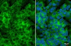 Invitrogen YTHDF3 Recombinant Rabbit Monoclonal Antibody (HL2235) 100 &mu;L;