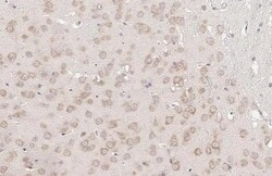 Invitrogen YTHDF3 Recombinant Rabbit Monoclonal Antibody (HL2235) 100 &mu;L;