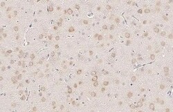 Invitrogen YTHDF3 Recombinant Rabbit Monoclonal Antibody (HL2235) 100 &mu;L;