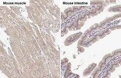 Invitrogen SPG7 Recombinant Rabbit Monoclonal Antibody (HL2236) 100 &mu;L;