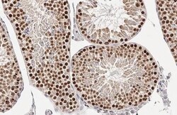 Invitrogen p53 Recombinant Rabbit Monoclonal Antibody (HL2242) 100 &mu;L | Buy Online | Invitrogen&trade; | Fisher Scientific