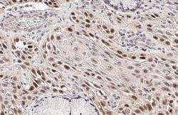 Invitrogen p53 Recombinant Rabbit Monoclonal Antibody (HL2242) 100 &mu;L | Buy Online | Invitrogen&trade; | Fisher Scientific