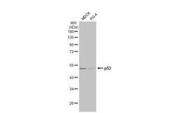 Invitrogen p53 Recombinant Rabbit Monoclonal Antibody (HL2242) 100 &mu;L | Buy Online | Invitrogen&trade; | Fisher Scientific