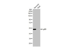 Invitrogen p53 Recombinant Rabbit Monoclonal Antibody (HL2242) 100 &mu;L | Buy Online | Invitrogen&trade; | Fisher Scientific