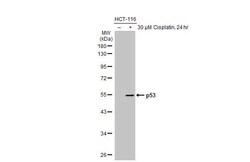 Invitrogen p53 Recombinant Rabbit Monoclonal Antibody (HL2242) 100 &mu;L | Buy Online | Invitrogen&trade; | Fisher Scientific