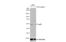 Invitrogen p53 Recombinant Rabbit Monoclonal Antibody (HL2242) 100 &mu;L | Buy Online | Invitrogen&trade; | Fisher Scientific