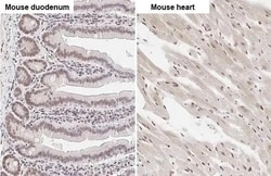 Invitrogen ZEB1 Recombinant Rabbit Monoclonal Antibody (HL2245) 100 &mu;L;