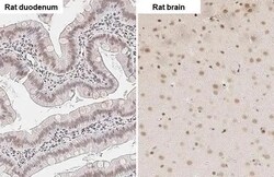 Invitrogen ZEB1 Recombinant Rabbit Monoclonal Antibody (HL2245) 100 &mu;L;