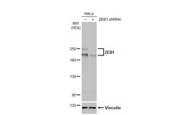 Invitrogen ZEB1 Recombinant Rabbit Monoclonal Antibody (HL2245) 100 &mu;L;