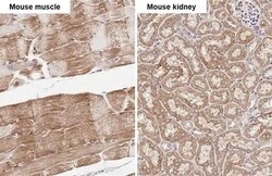 Invitrogen SDHB Recombinant Rabbit Monoclonal Antibody (HL2251) 100 &mu;L | Buy Online | Invitrogen&trade; | Fisher Scientific