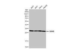 Invitrogen SDHB Recombinant Rabbit Monoclonal Antibody (HL2251) 100 &mu;L | Buy Online | Invitrogen&trade; | Fisher Scientific
