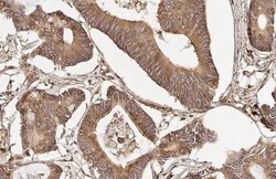 Invitrogen RPLP2 Recombinant Rabbit Monoclonal Antibody (HL2256) 100 &mu;L;