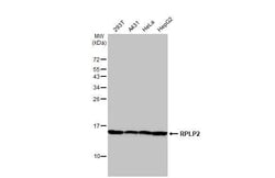 Invitrogen RPLP2 Recombinant Rabbit Monoclonal Antibody (HL2256) 100 &mu;L;
