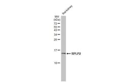 Invitrogen RPLP2 Recombinant Rabbit Monoclonal Antibody (HL2256) 100 &mu;L;