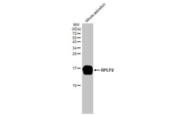 Invitrogen RPLP2 Recombinant Rabbit Monoclonal Antibody (HL2256) 100 &mu;L;