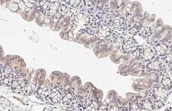 Invitrogen CARD10 Recombinant Rabbit Monoclonal Antibody (HL2260) 100 &mu;L;