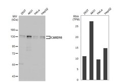 Invitrogen CARD10 Recombinant Rabbit Monoclonal Antibody (HL2260) 100 &mu;L;