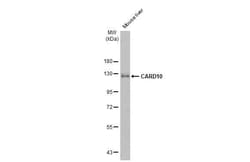 Invitrogen CARD10 Recombinant Rabbit Monoclonal Antibody (HL2260) 100 &mu;L;