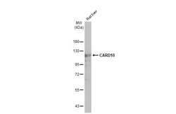 Invitrogen CARD10 Recombinant Rabbit Monoclonal Antibody (HL2261) 100 &mu;L;