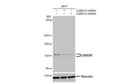Invitrogen CARD10 Recombinant Rabbit Monoclonal Antibody (HL2261) 100 &mu;L;