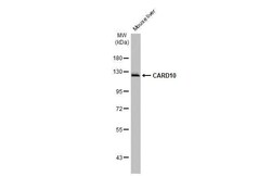 Invitrogen CARD10 Recombinant Rabbit Monoclonal Antibody (HL2261) 100 &mu;L;