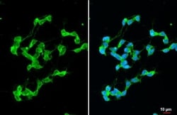 Invitrogen Stargazin Recombinant Rabbit Monoclonal Antibody (HL2268) 100
