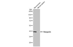 Invitrogen Stargazin Recombinant Rabbit Monoclonal Antibody (HL2268) 100