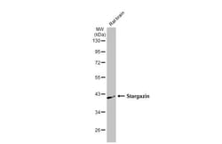 Invitrogen Stargazin Recombinant Rabbit Monoclonal Antibody (HL2268) 100
