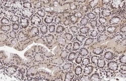 Invitrogen KLF5 Recombinant Rabbit Monoclonal Antibody (HL2269) 100 &mu;L;