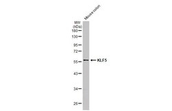 Invitrogen KLF5 Recombinant Rabbit Monoclonal Antibody (HL2269) 100 &mu;L;
