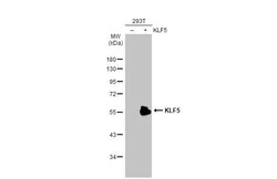 Invitrogen KLF5 Recombinant Rabbit Monoclonal Antibody (HL2269) 100 &mu;L;