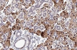 Invitrogen GPS2 Recombinant Rabbit Monoclonal Antibody (HL2276) 100 &mu;L;