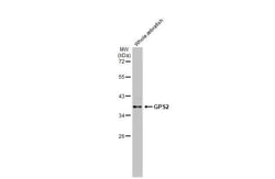 Invitrogen GPS2 Recombinant Rabbit Monoclonal Antibody (HL2276) 100 &mu;L;