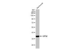 Invitrogen GPS2 Recombinant Rabbit Monoclonal Antibody (HL2276) 100 &mu;L;