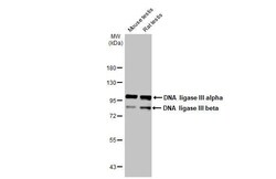 Invitrogen DNA Ligase III Recombinant Rabbit Monoclonal Antibody (HL2280)