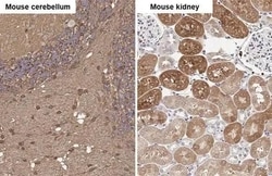 Invitrogen Glutamine Synthetase Recombinant Rabbit Monoclonal Antibody (HL2283) 100 &mu;L | Buy Online | Invitrogen&trade; | Fisher Scientific