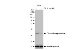 Invitrogen Glutamine Synthetase Recombinant Rabbit Monoclonal Antibody (HL2283) 100 &mu;L | Buy Online | Invitrogen&trade; | Fisher Scientific