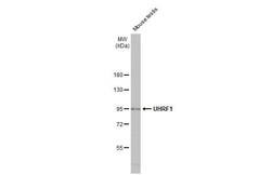 Invitrogen UHRF1 Recombinant Rabbit Monoclonal Antibody (HL2287) 100 &mu;L;