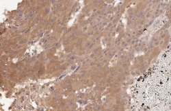 Invitrogen VEGFC Recombinant Rabbit Monoclonal Antibody (HL2289) 100 &mu;L;