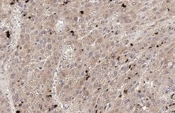 Invitrogen VEGFC Recombinant Rabbit Monoclonal Antibody (HL2289) 100 &mu;L;
